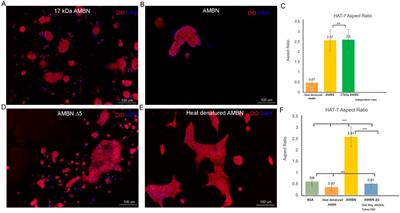 Modeling ameloblast-matrix interactions using 3D cell culture